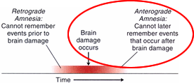 anteroamnesia.png